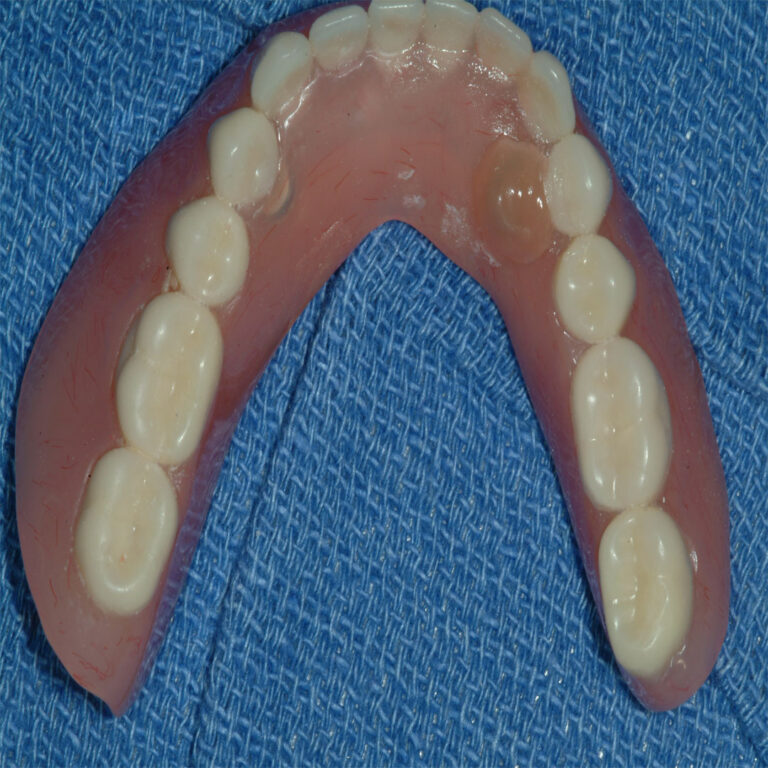A close up of an open mouth with teeth