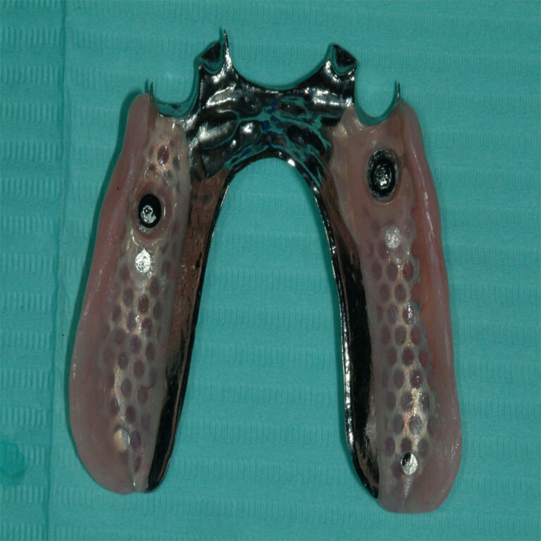 A pair of metal gloves on top of a green surface.