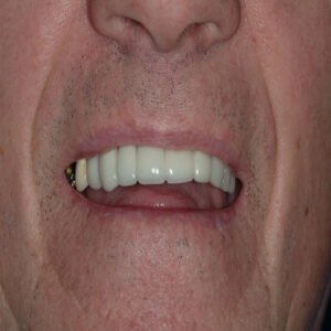 A man with white teeth and no smile.