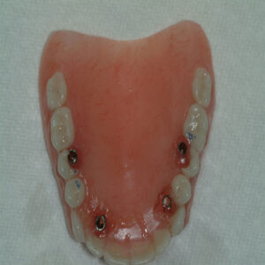 A close up of an artificial tooth with teeth missing