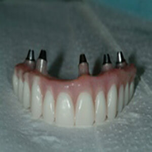 A close up of a tooth with four teeth