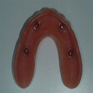 A red plastic mouth guard with four metal rivets.